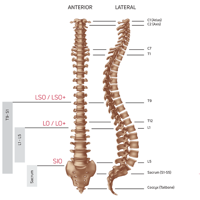 DONJOY ISOFORM® SIO Back Brace