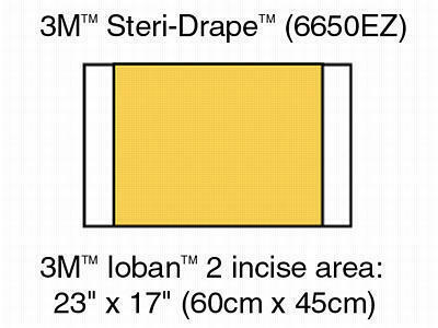 Diagram of 3M Steri-Drape 6650EZ showing a yellow Ioban 2 incise area measuring 23 by 17 inches on a white background.