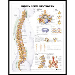 The HUMAN SPINE DISORDERS LAMINATED-ACC- 9970