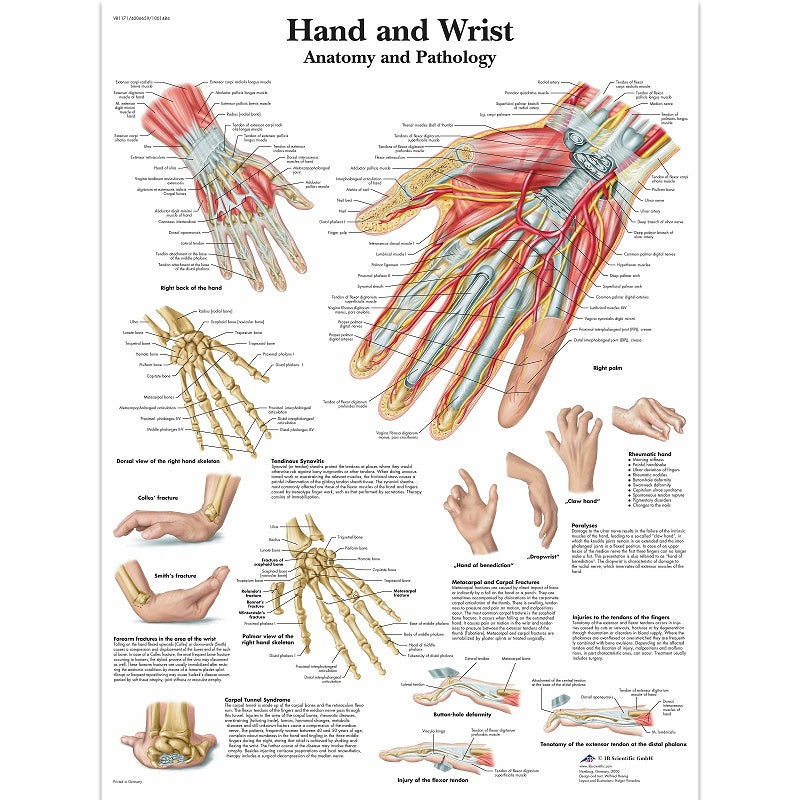 Hand and Wrist Chart - Anatomy and Pathology